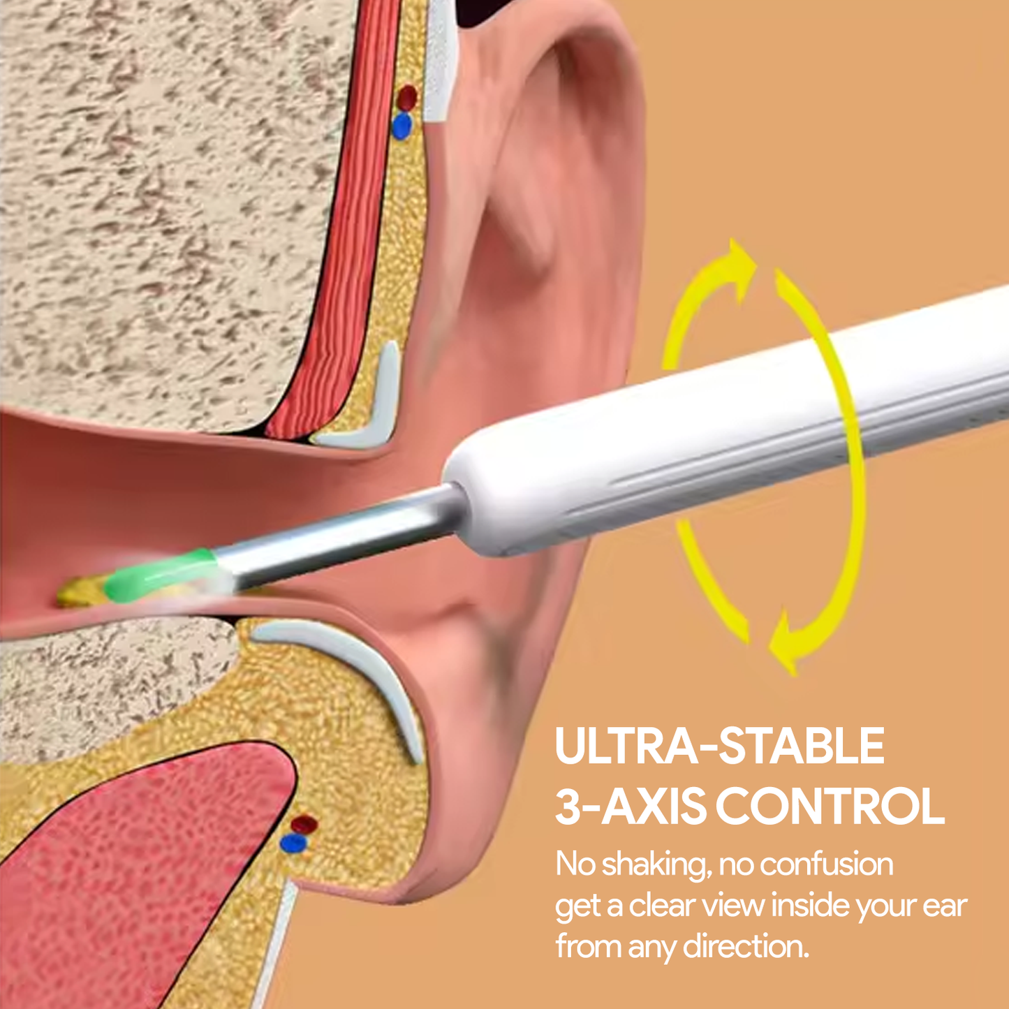 Illustration of an ear with a Nuwelo Clear Ear Wax Removal tool inside the ear showing ultra-stable 3-axis control feature.