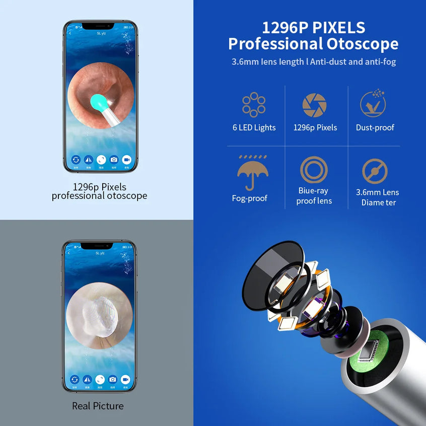 Professional otoscope with smartphone display and feature highlights on a blue background